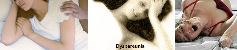 Dyspareunia
